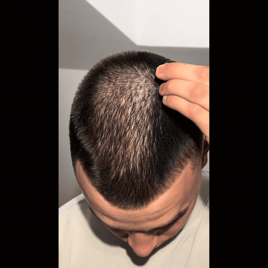 Hair Concealer für Männer – Sofort dichteres Haar in Sekunden